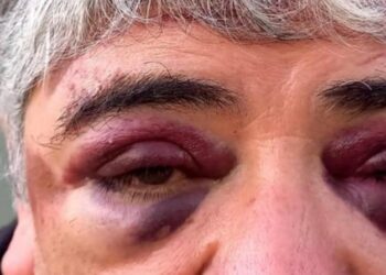 “Hoy lo podemos contar, porque sí no estaríamos hablando de otra cosa”. Dijo la esposa de Hugo Aguilar