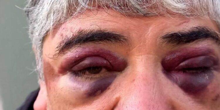 “Hoy lo podemos contar, porque sí no estaríamos hablando de otra cosa”. Dijo la esposa de Hugo Aguilar