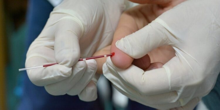 Doble jornada gratuita y confidencial de testeos rápidos de HIV y Sífilis