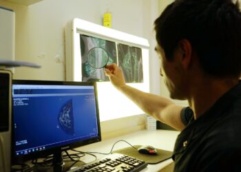 “El número de mamografías en octubre fue muy importante, pero el servicio está disponible todo el año”