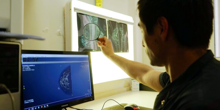 “El número de mamografías en octubre fue muy importante, pero el servicio está disponible todo el año”