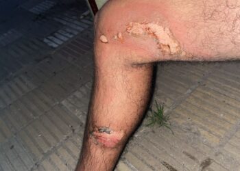 Chocó a una moto y se dio a la fuga: buscan a una Duster azul