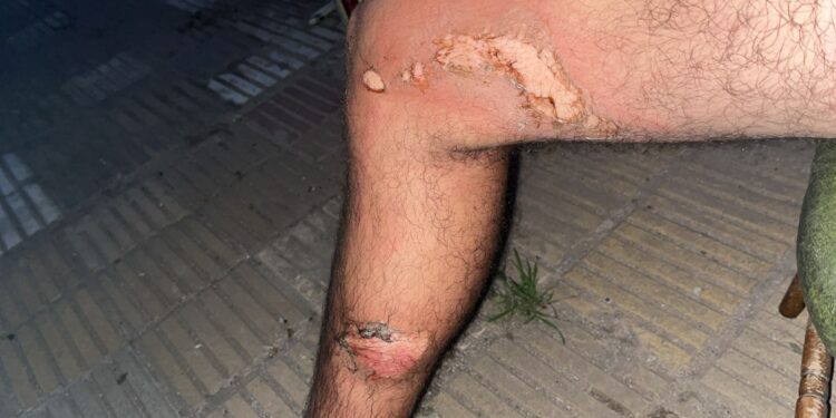 Chocó a una moto y se dio a la fuga: buscan a una Duster azul